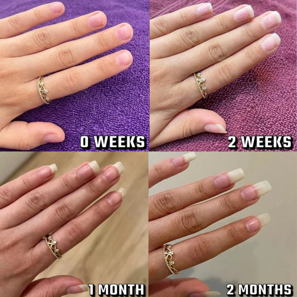 Nail Growth Oil  ( Cuticle Oil ) Nail Nutrition Care / Born Pretty Cuticle oil